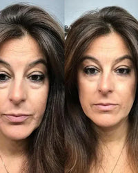 Avis client crème Celyn, contour de l'oeil