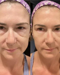 Avis client crème Celyn, poches sous les yeux