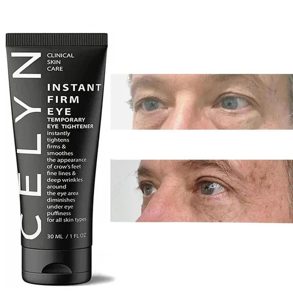 Crème Celyn et effet sur les ridules du contour de l'oeil
