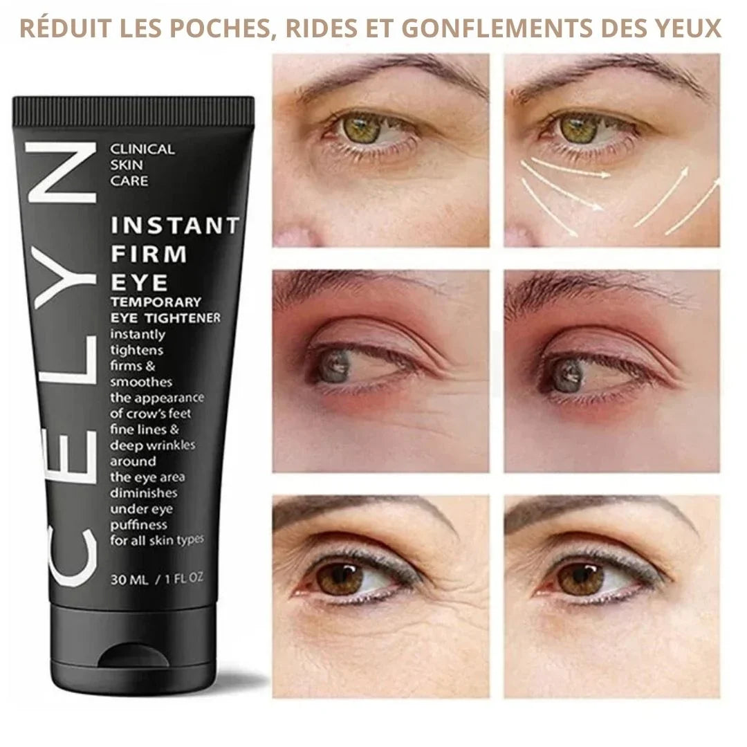 Crème Celyn : poches, rides et gonflements du contour de l'oeil